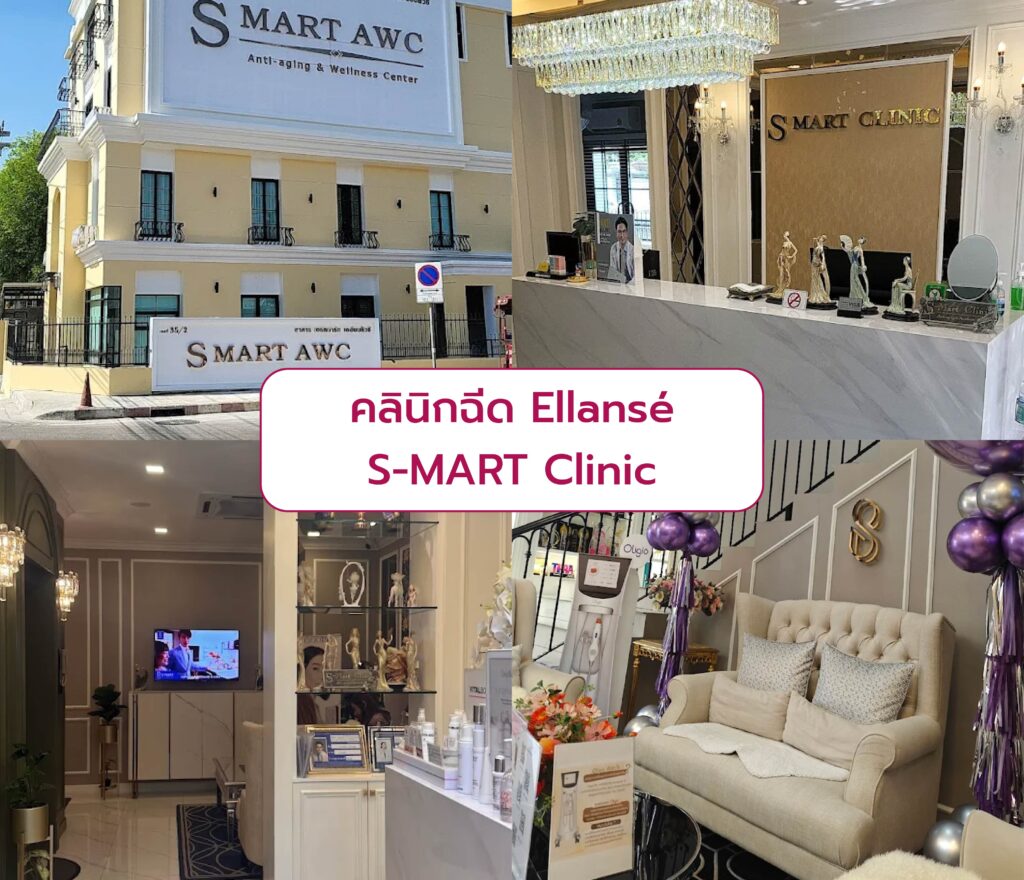 คลินิกฉีด Ellanse S-MART Clinic