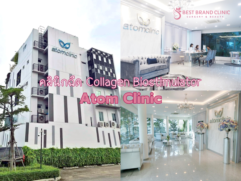 Best Collagen Biostimulator Clinic Atom Clinic