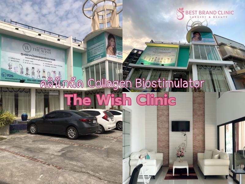 Best Collagen Biostimulator Clinic The Wish Clinic
