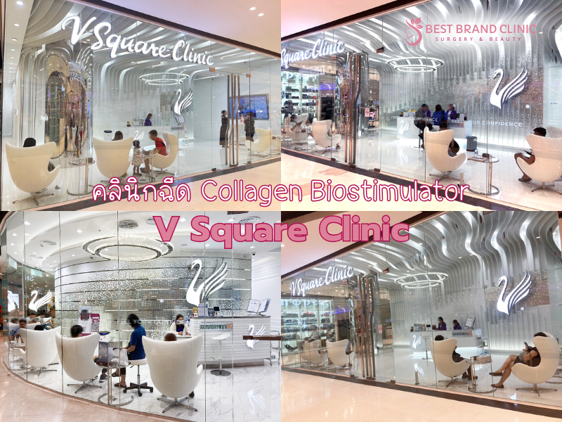 Best Collagen Biostimulator Clinic V Square Clinic