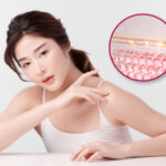 Best collagen biostimulator clinic-370x277