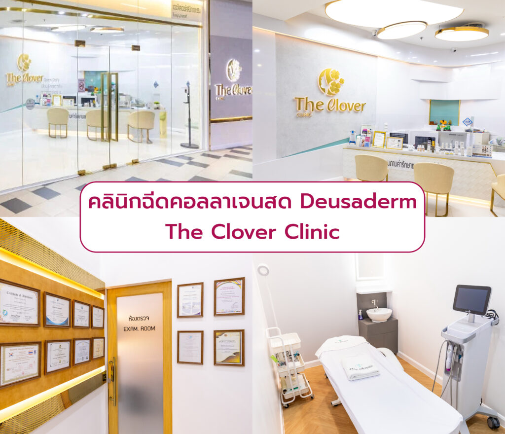 คลินิกฉีดคอลลาเจนสด Deusaderm The Clover Clinic