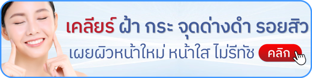 โปรโมชันโบท็อก v square