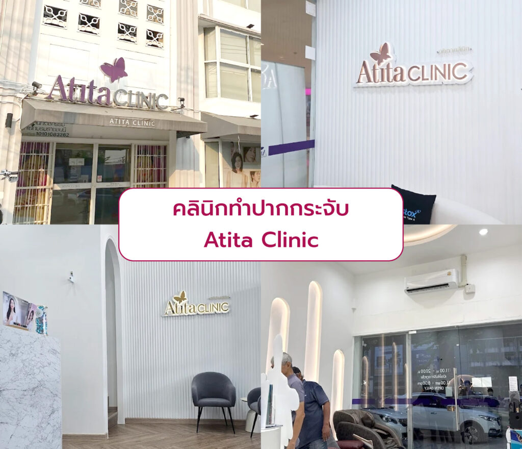 คลินิกทำปากกระจับ Atita Clinic