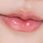 ทำปากกระจับ ที่ไหนดี370x277